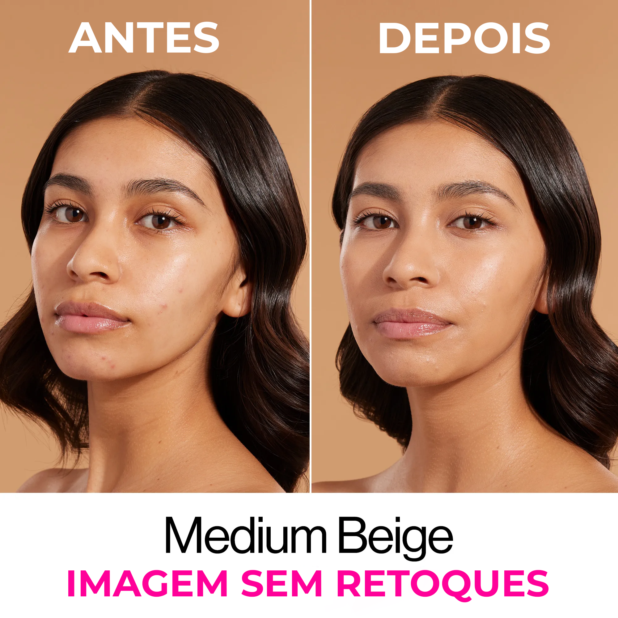 Base Niacinamida - Bare Focus - Medium Beige